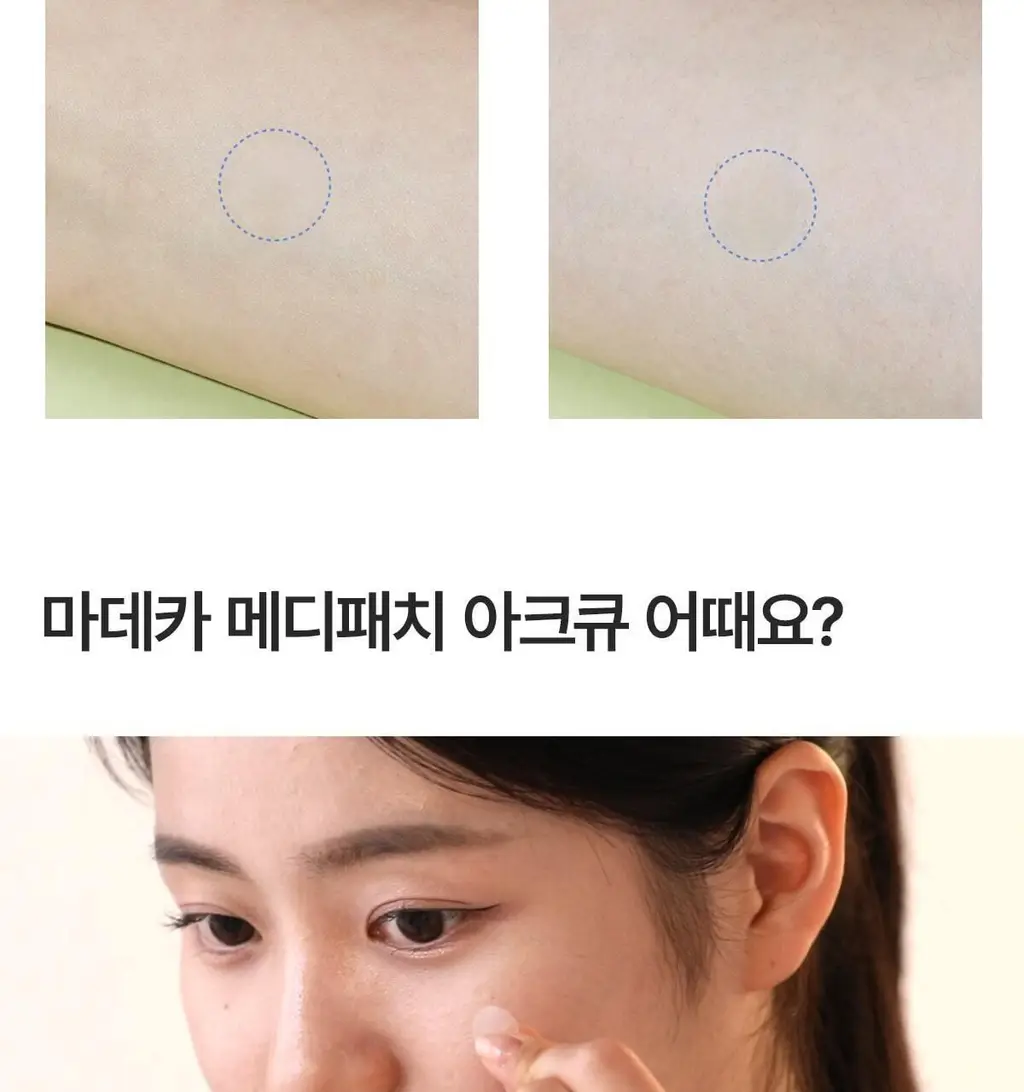[단독기획] 마데카 메디패치 아크큐 (짜기전/낮케어) 84매/122매 상세페이지 17